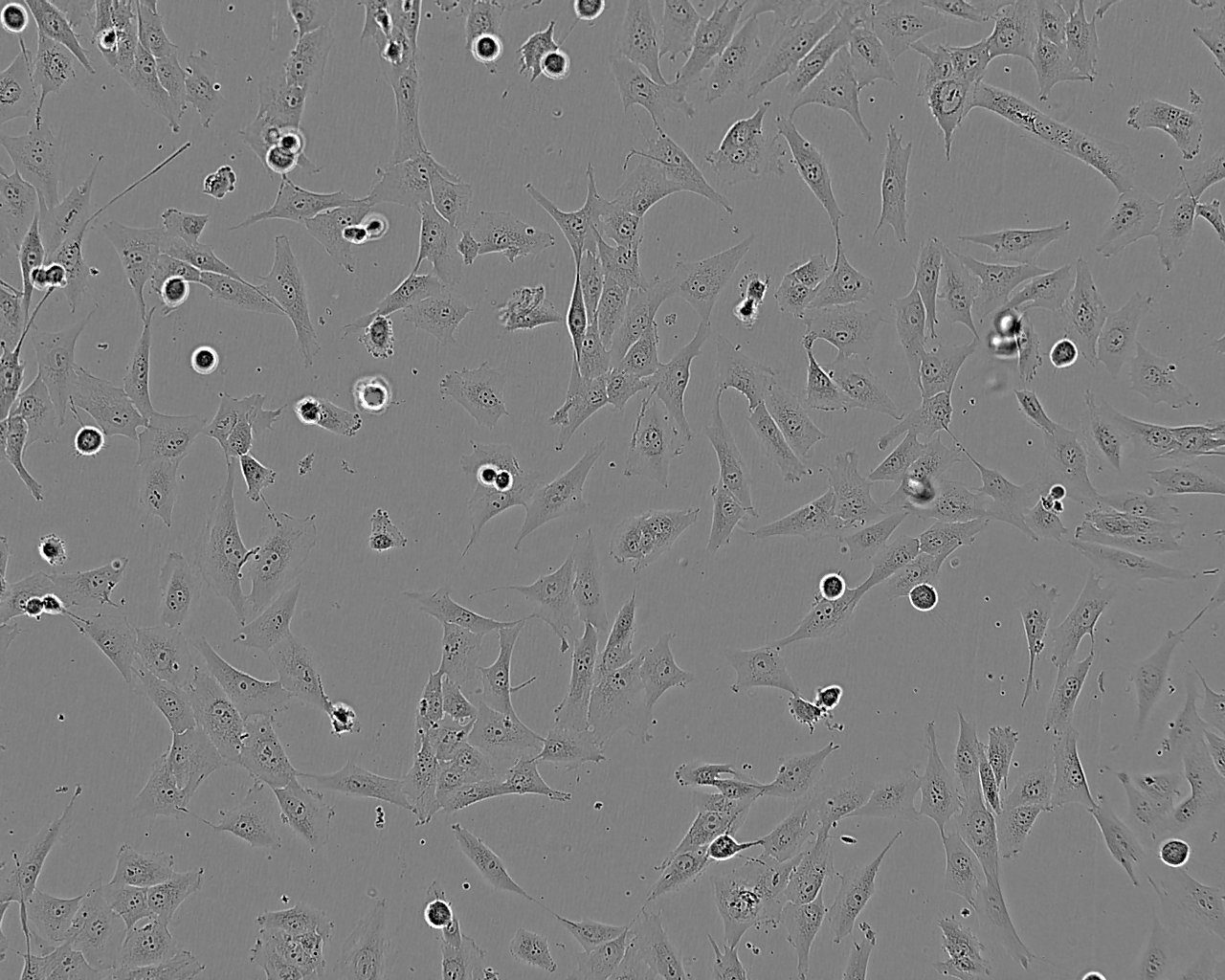 CCD-18Co Cell:正常人结肠成纤维细胞系