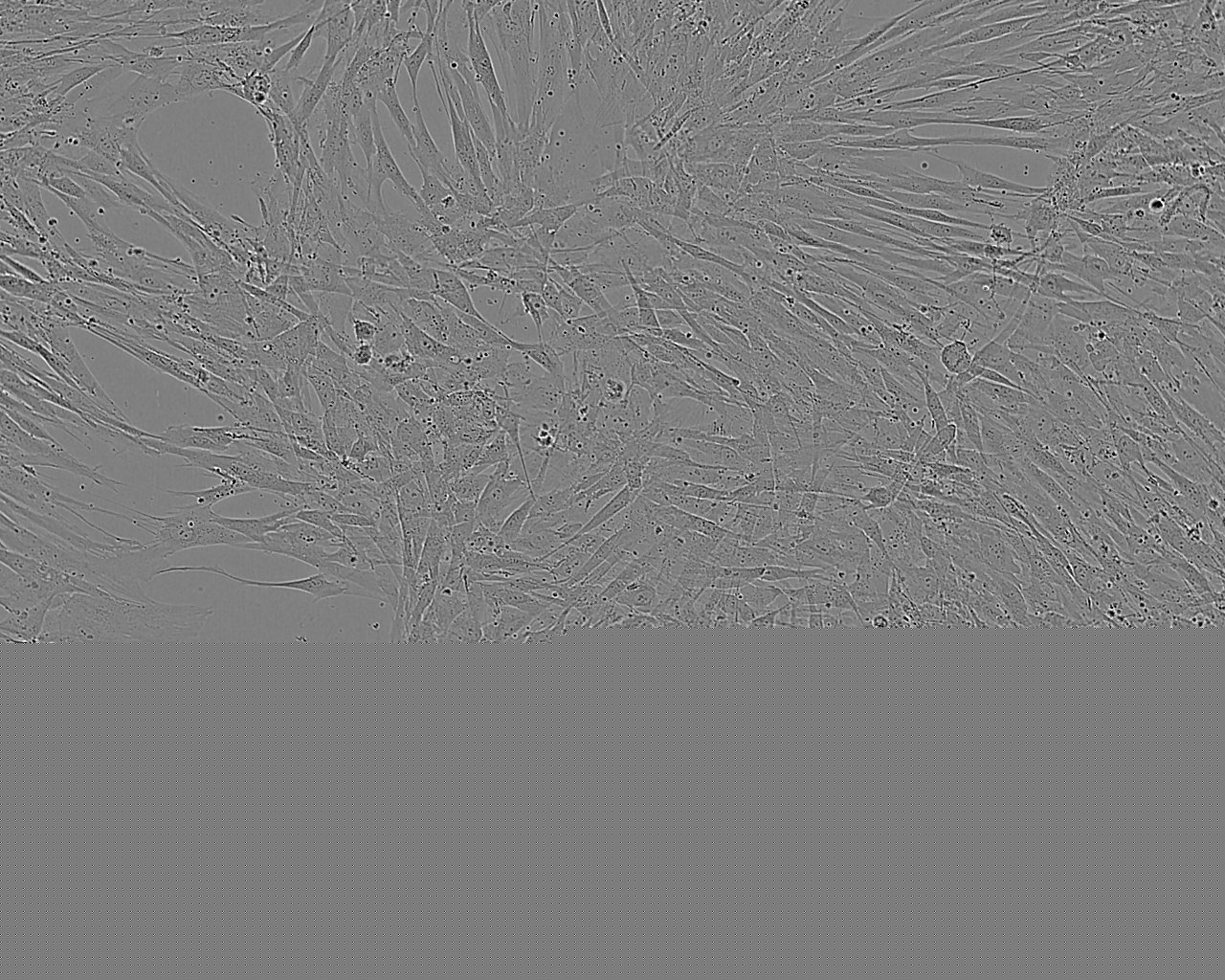 T/G HA-VSMC Cell:人血管平滑肌细胞系