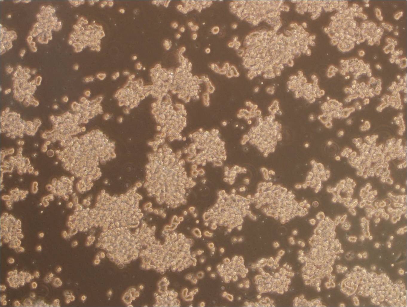 Toledo Cell:人皮肤T淋巴细胞瘤细胞系