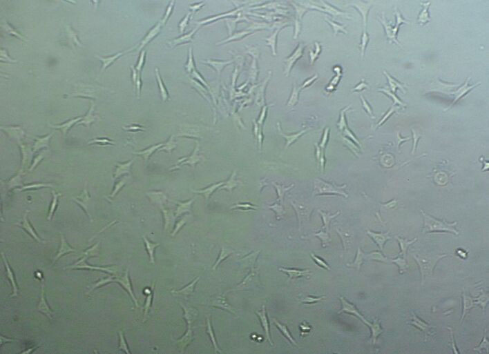 NCI-H1836 epithelioid cells人小细胞肺癌细胞系