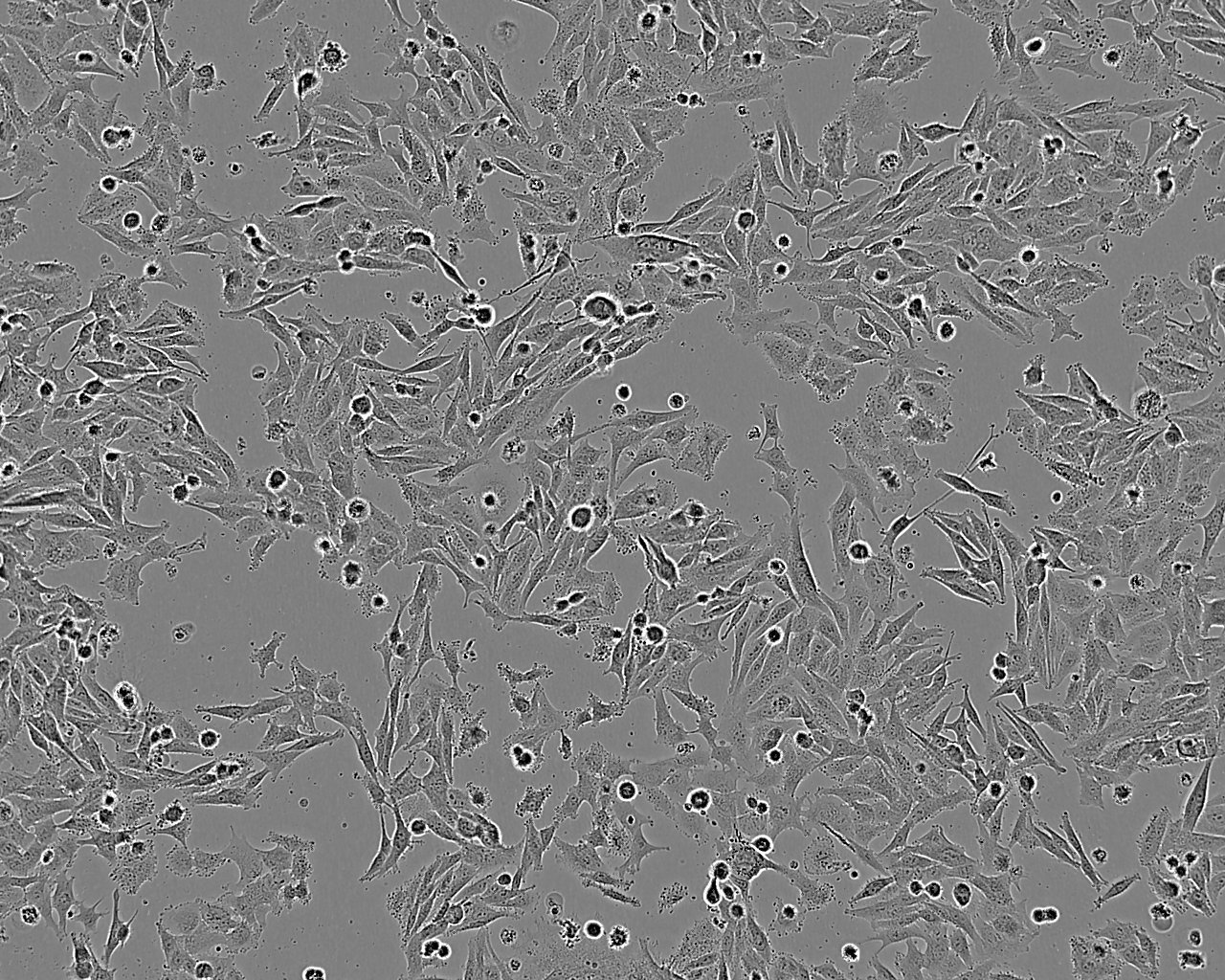 NCI-H1694 epithelioid cells人小细胞肺癌细胞系