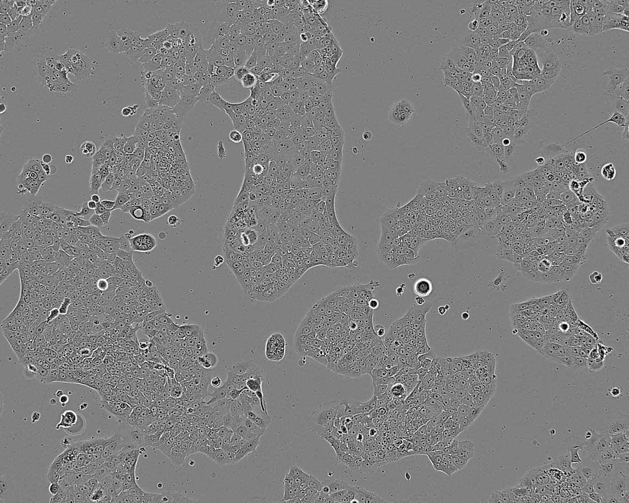 VMRC-RCZ epithelioid cells人肾细胞癌细胞系