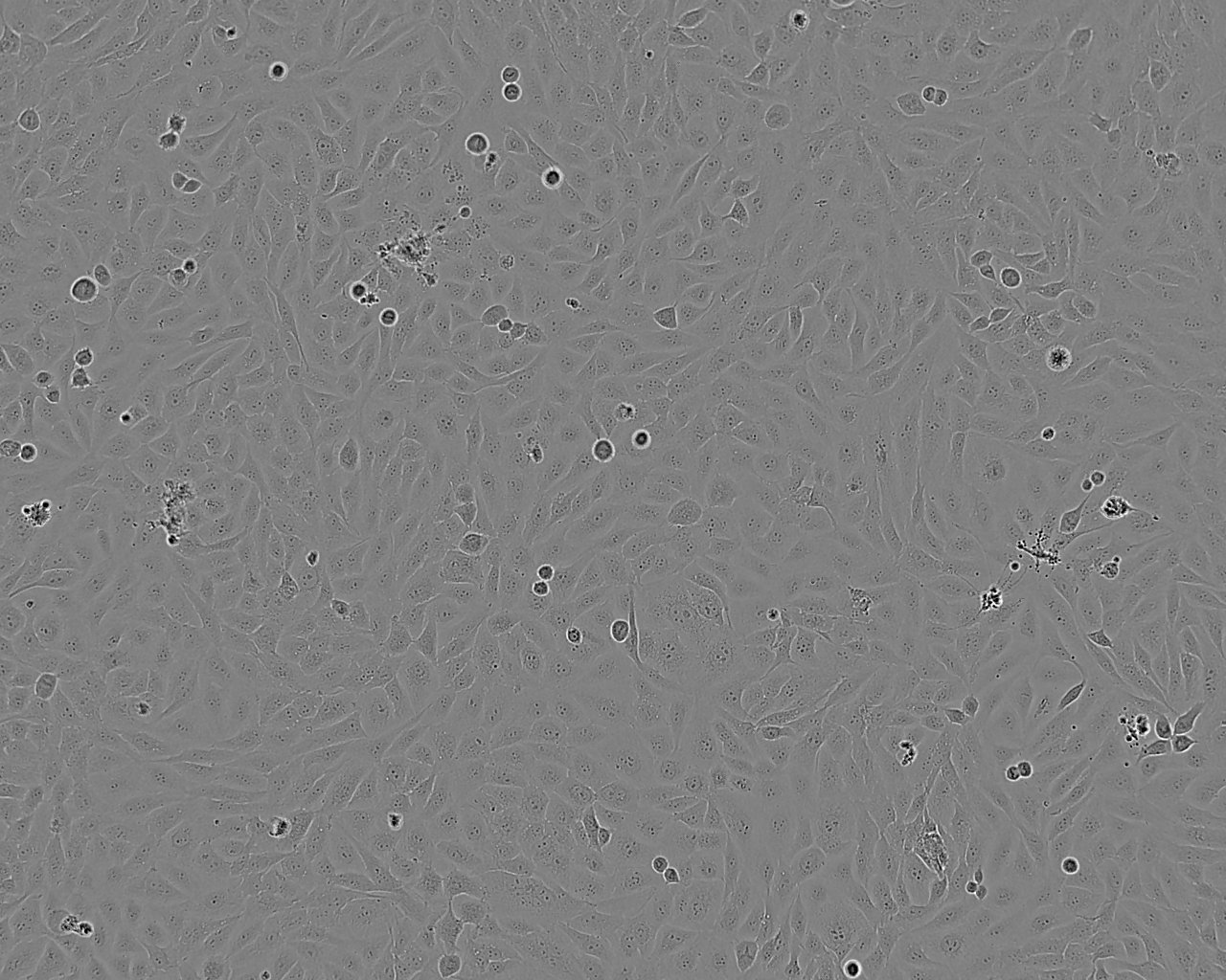 SNU-1 epithelioid cells人胃癌细胞系