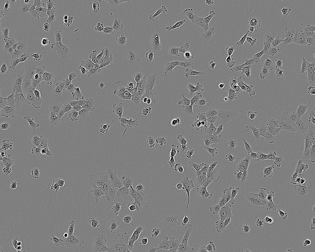 KNS-81 epithelioid cells人神经胶质瘤细胞系