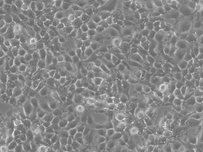 Eca-109 epithelioid cells人食管癌细胞系