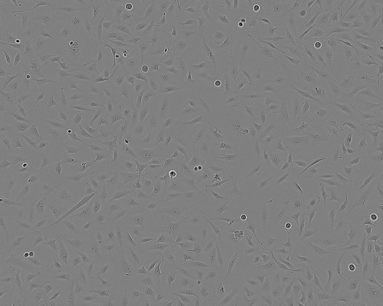 NOZ epithelioid cells人胆囊癌细胞系