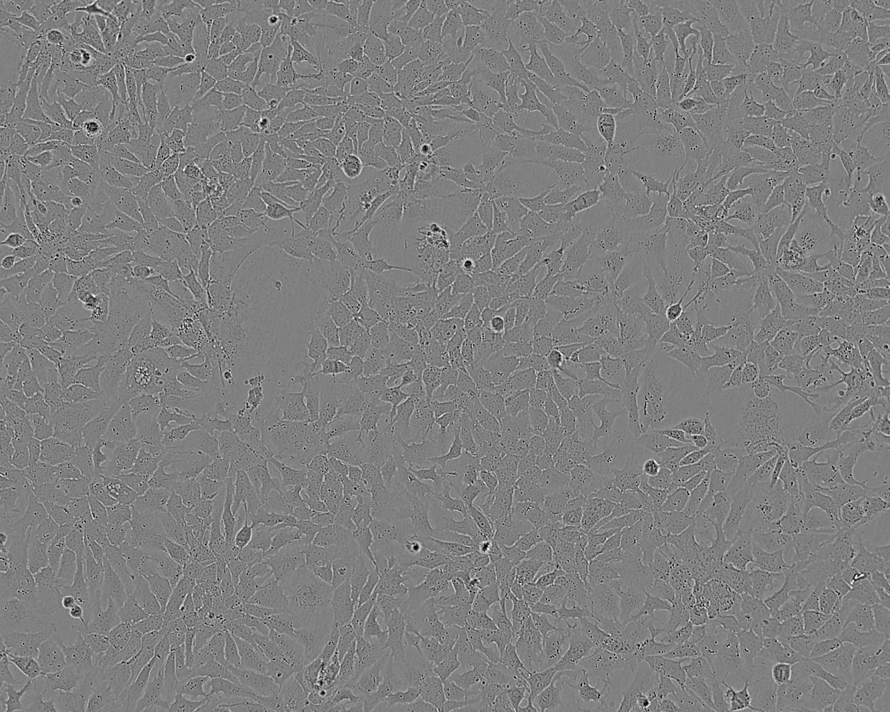 MM96L epithelioid cells人黑色素瘤细胞系
