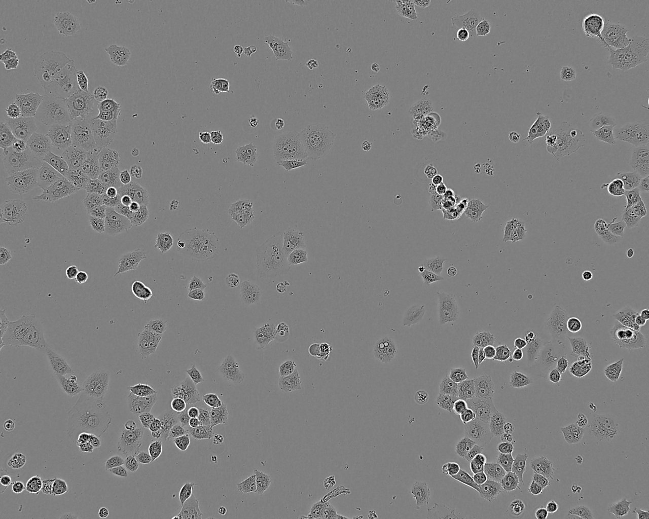 HHUA epithelioid cells人子宫内膜癌细胞系