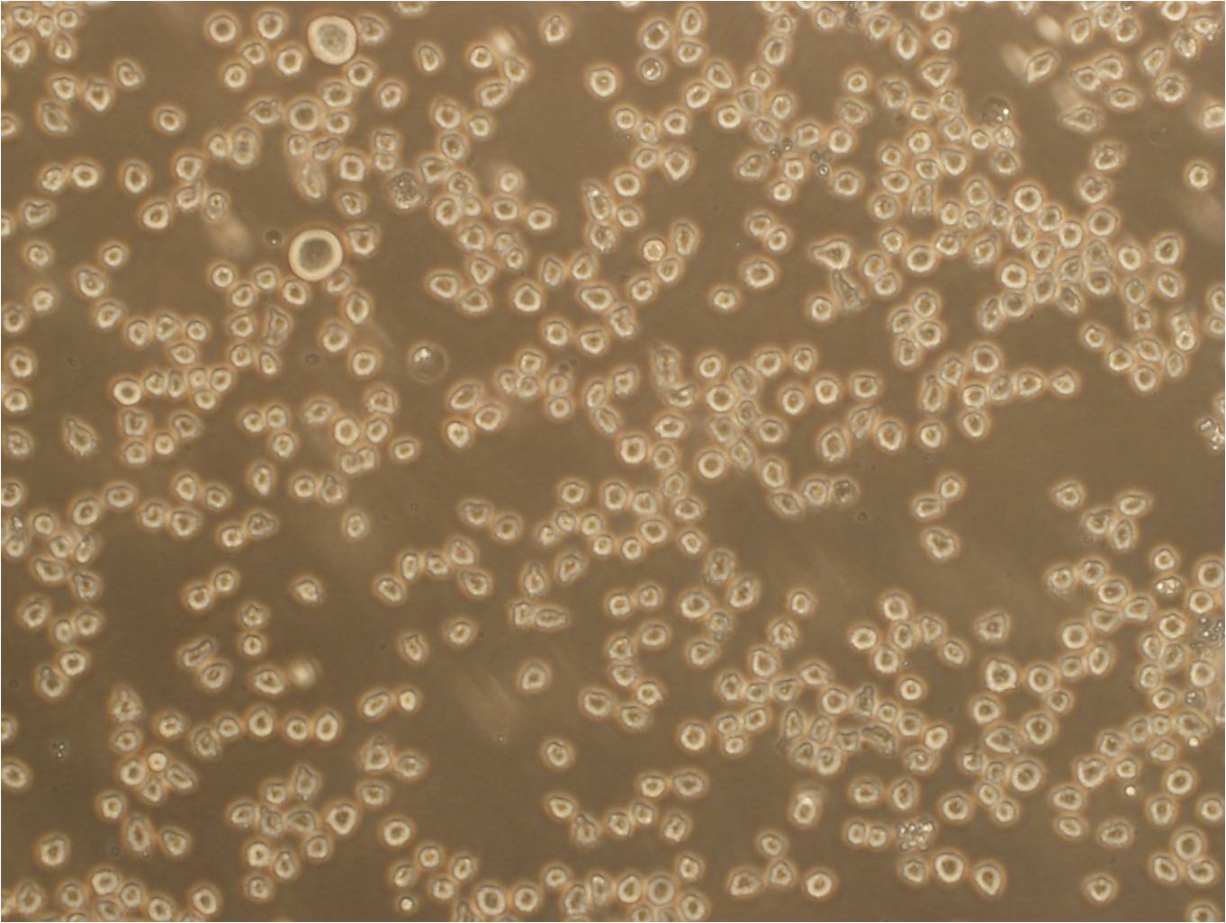 GDM-1 Lymphoblastoid cells人白血病细胞系