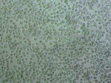 MLMA Lymphoblastoid cells人恶性淋巴瘤细胞系