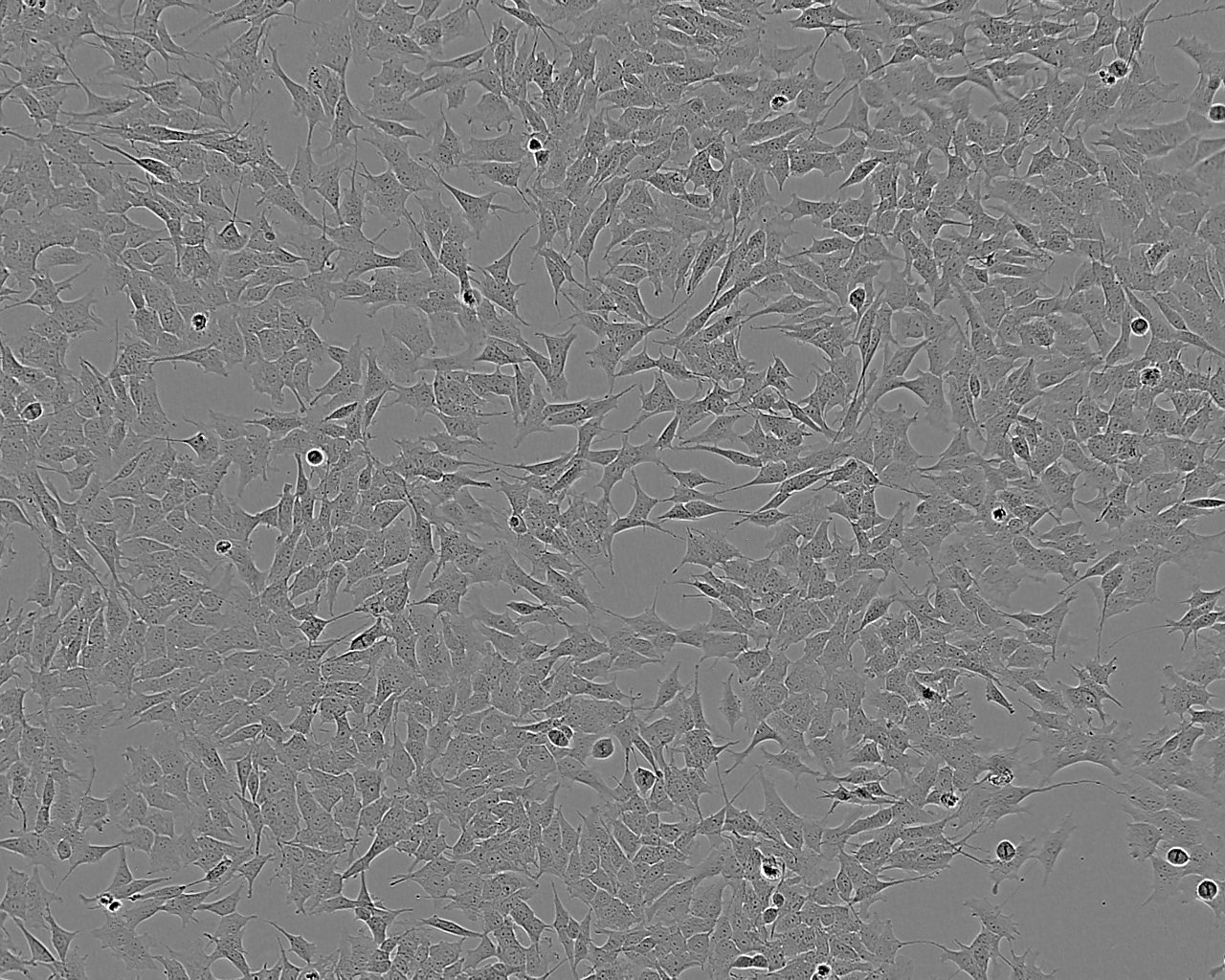 HDQ-P1 epithelioid cells人乳腺癌细胞系