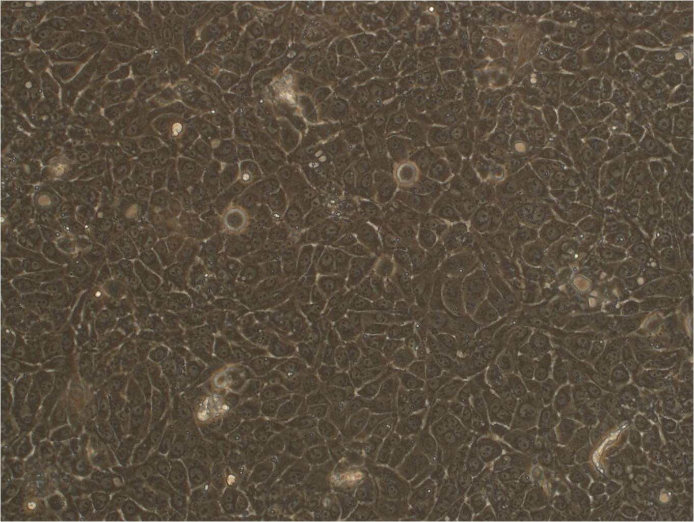 Hx147 epithelioid cells人肺癌细胞系