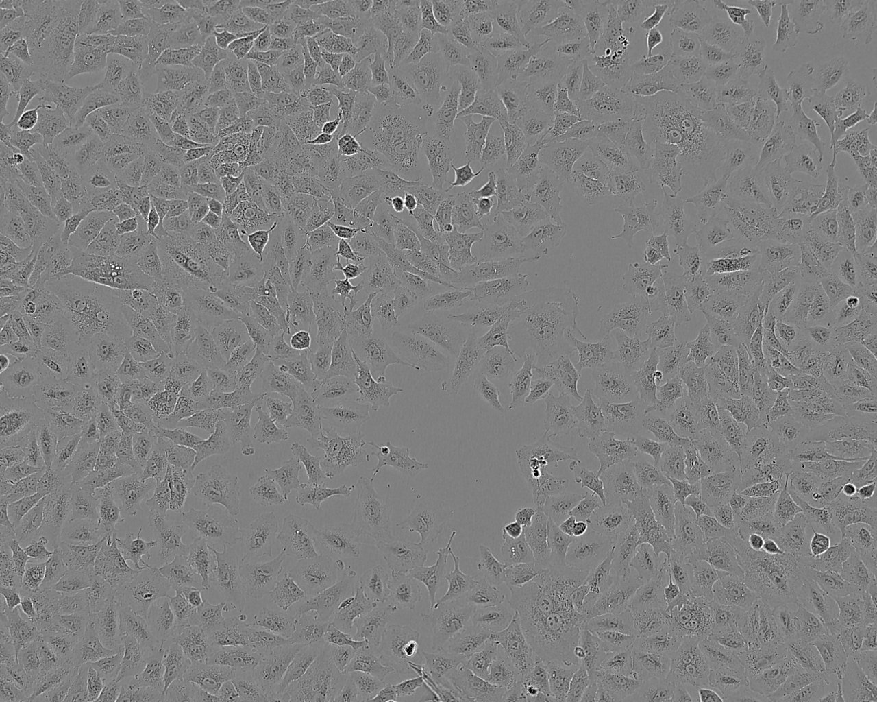 HCC1171 epithelioid cells人肺癌腺癌细胞系