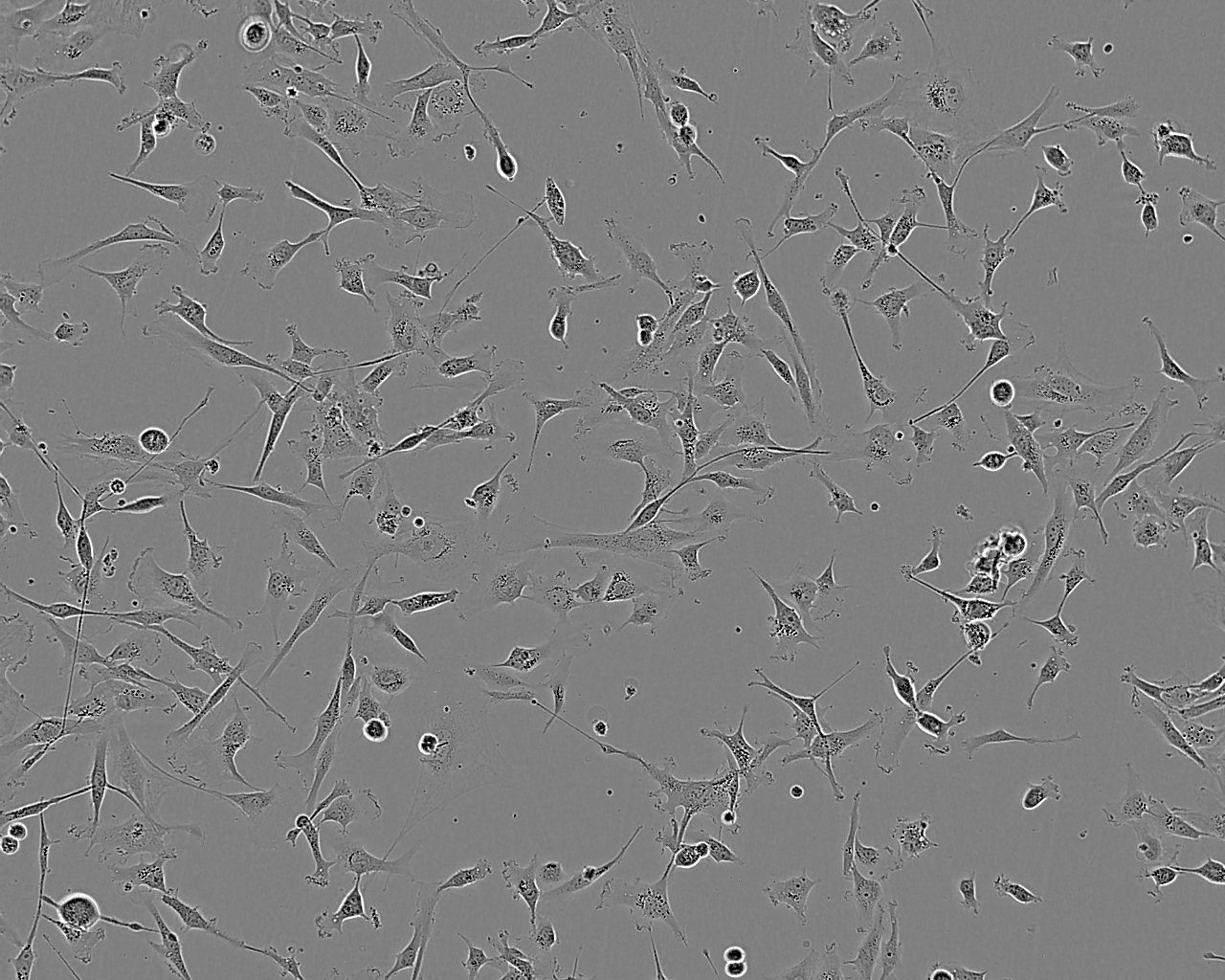 KMS-26 Adherent人多发性骨髓瘤细胞系