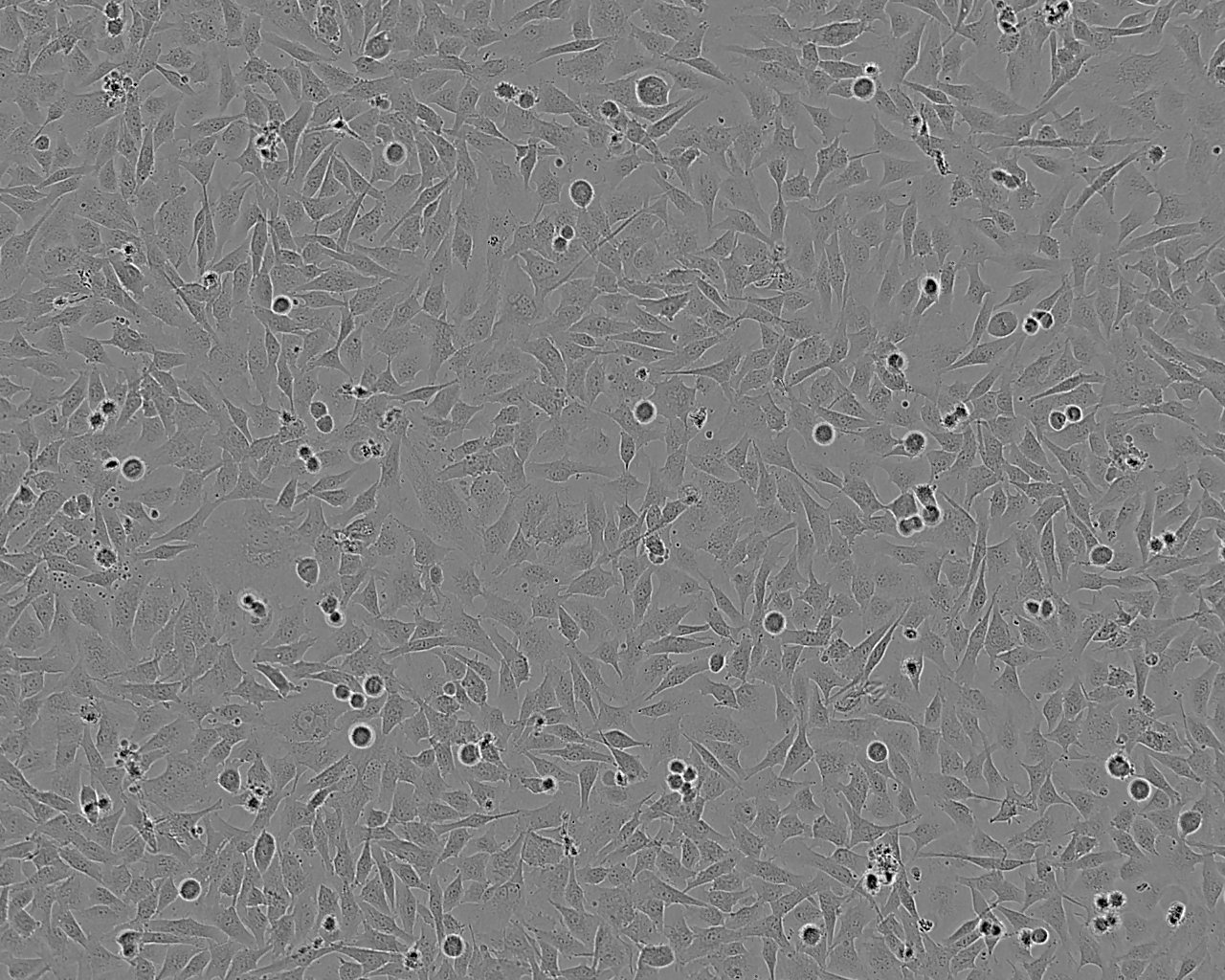 CCD-841CoN Adherent人正常结肠上皮细胞系