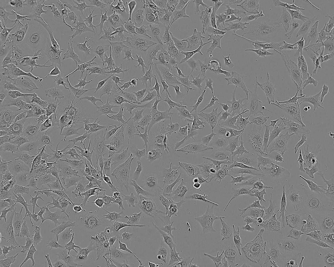 NCI-H128 Adherent人小细胞肺癌细胞系
