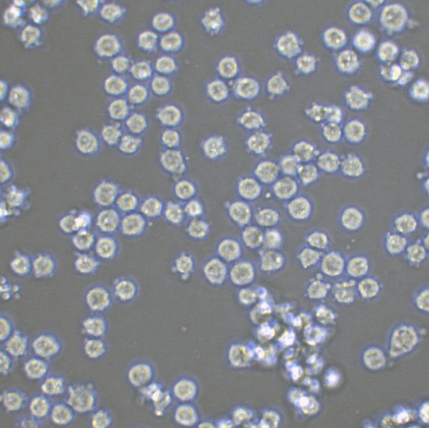 HH [Human lymphoma] Suspended人皮肤T淋巴细胞瘤细胞系