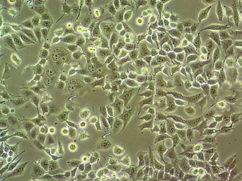 NCI-H1836 cell line人小细胞肺癌细胞系