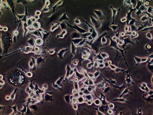 SUM159PT cell line人乳腺癌细胞系