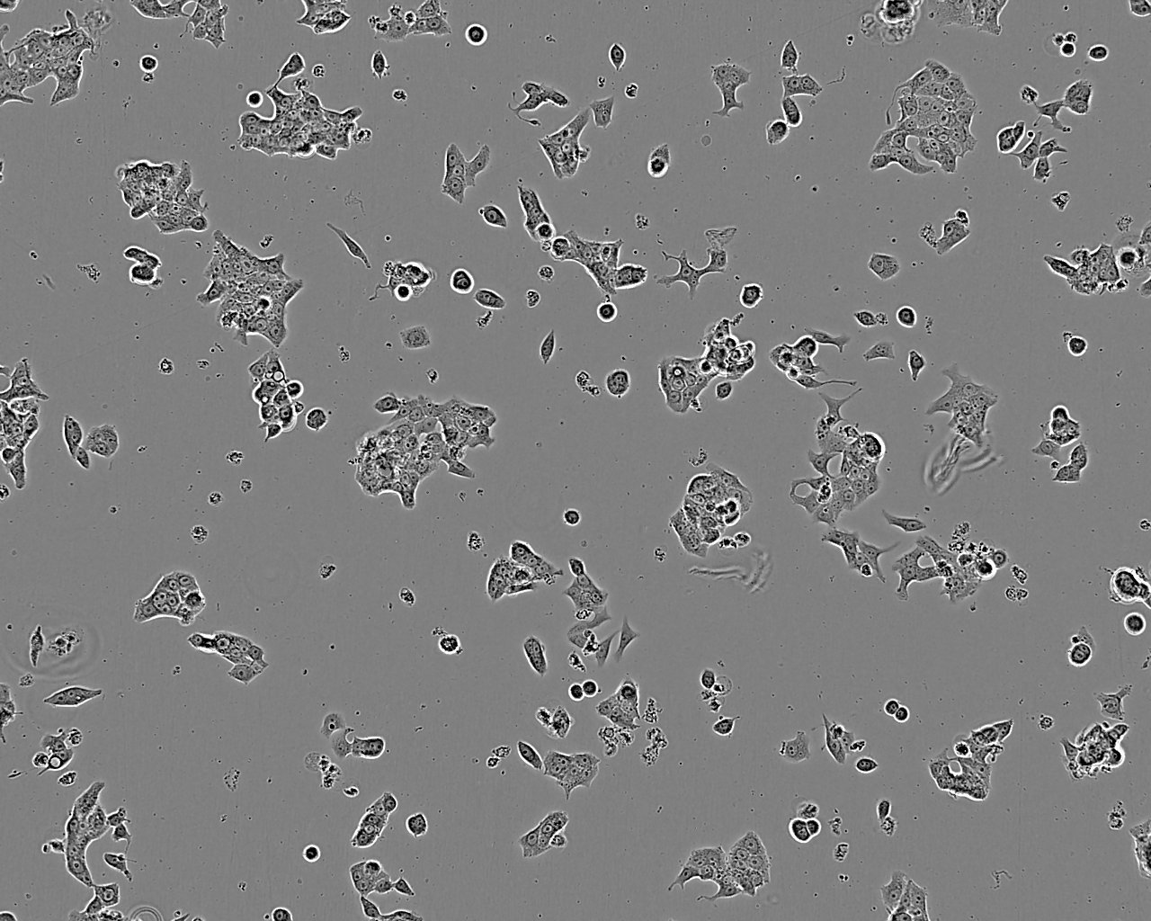 OVCA432 cell line人卵巢癌细胞系