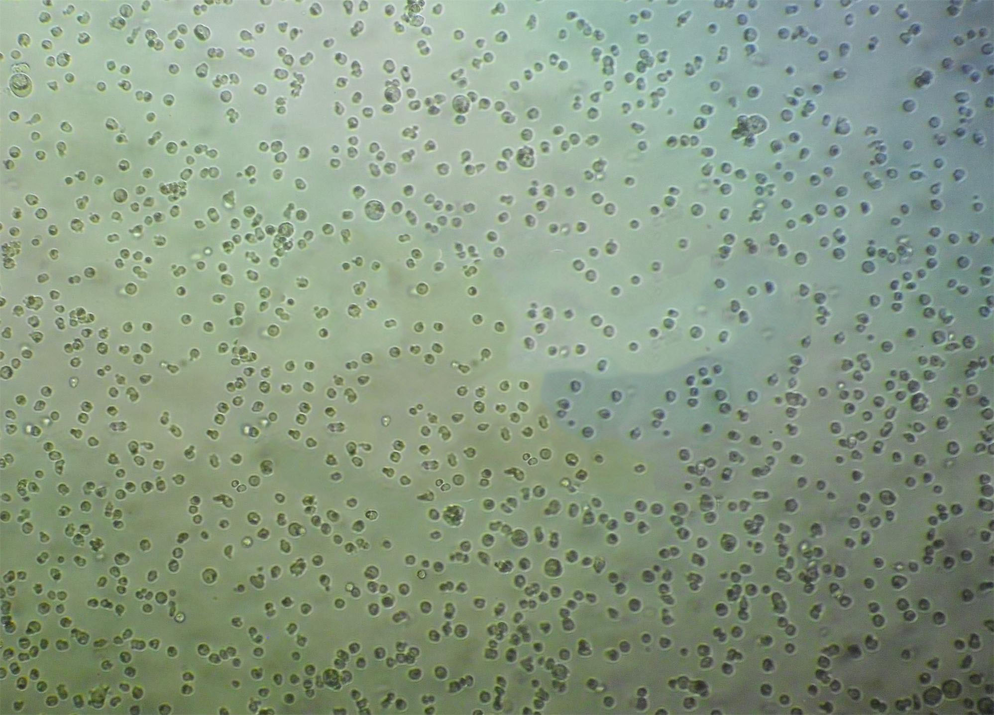 OCI-Ly7 cell line人弥漫大B淋巴瘤细胞系