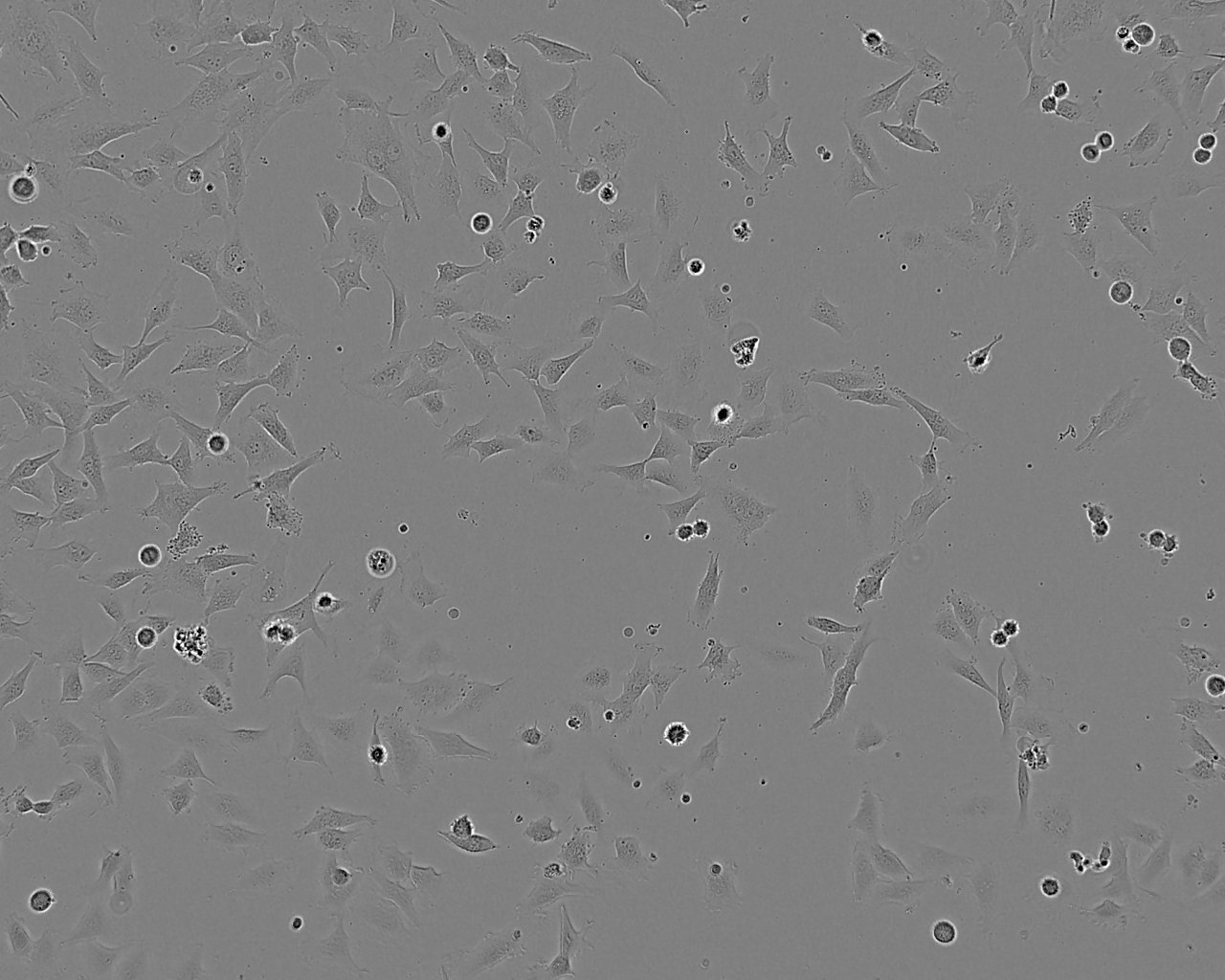 CCD-1095Sk 人乳腺浸润性导管癌旁皮肤细胞系