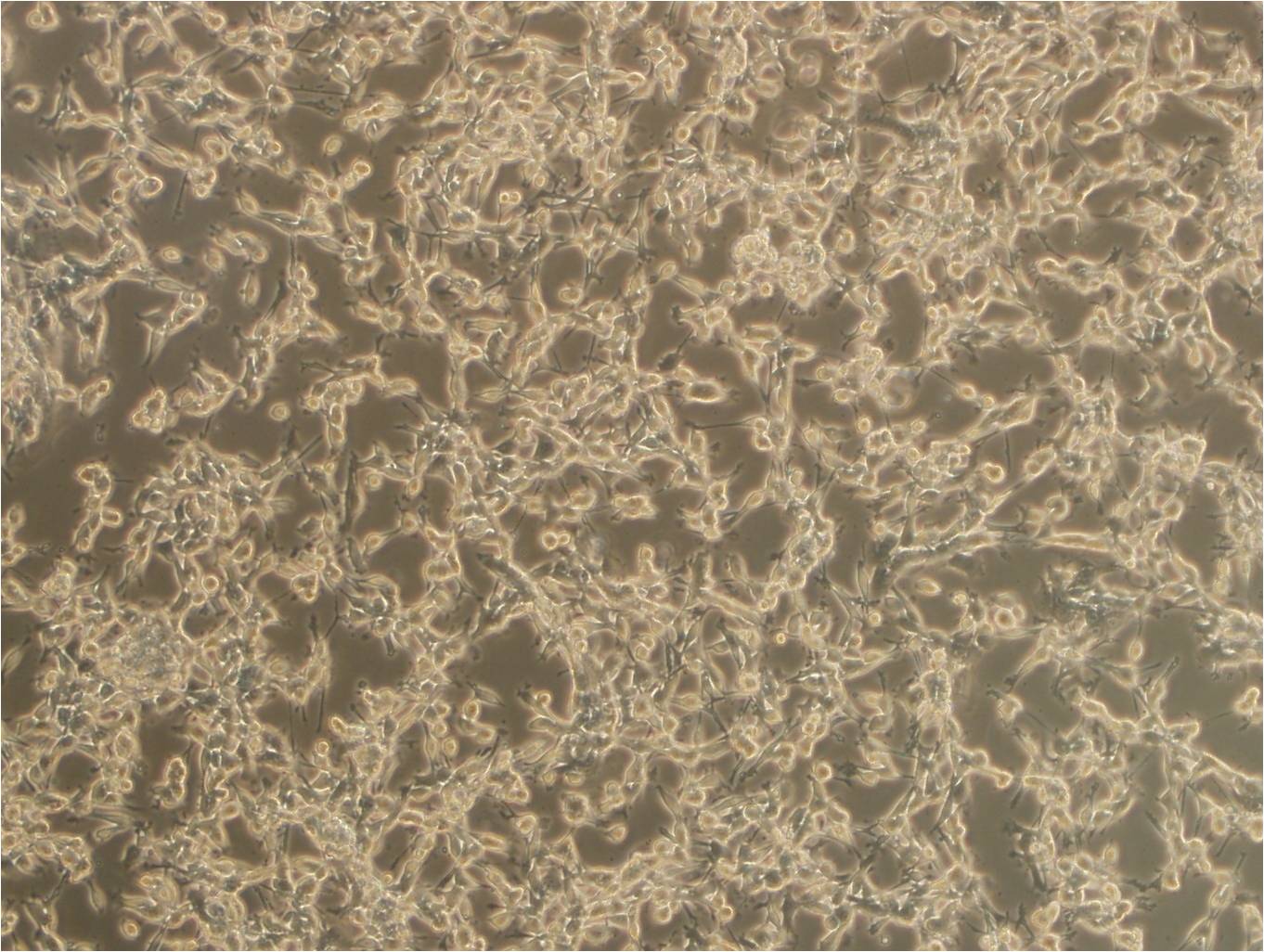 etr-3 cell line人肾癌细胞系