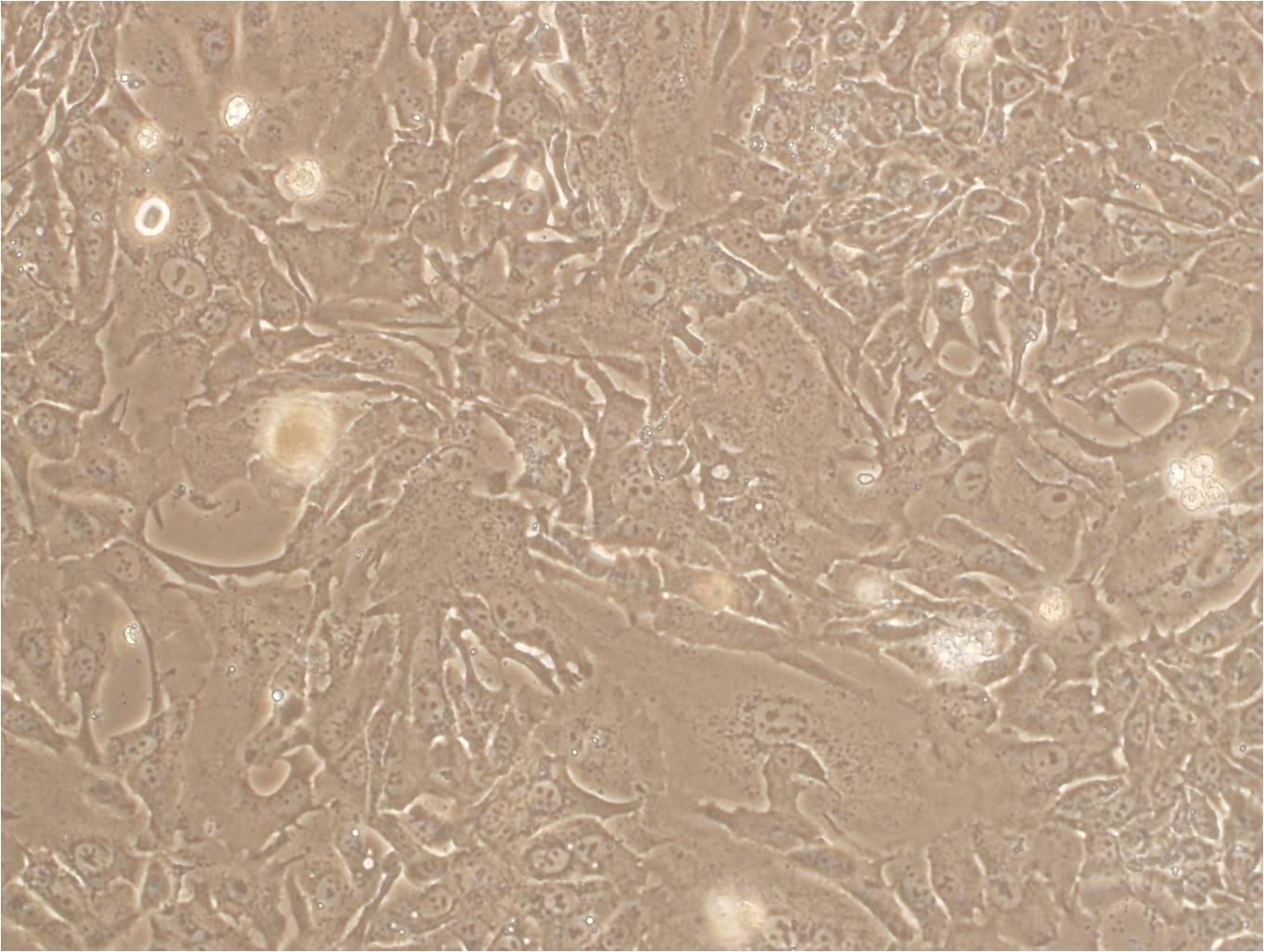 LNCaP C4-2B cell line人前列腺癌细胞系