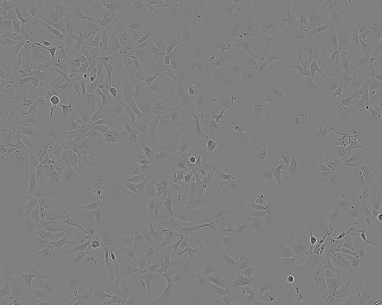 SW620细胞：人结肠癌细胞系