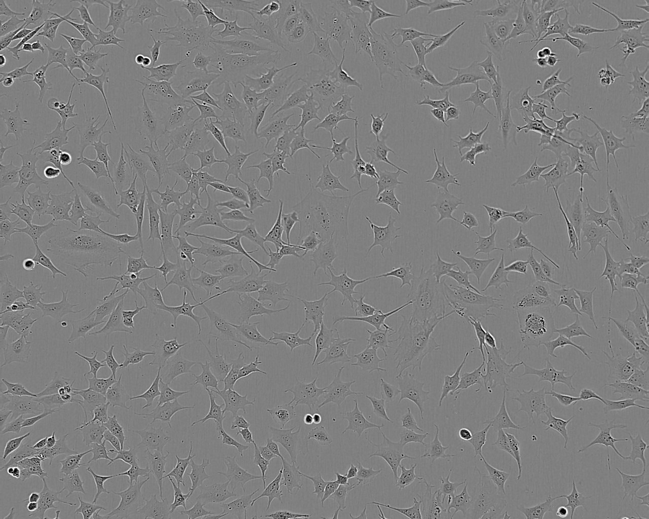 SK-MES-1细胞：人肺鳞癌细胞系