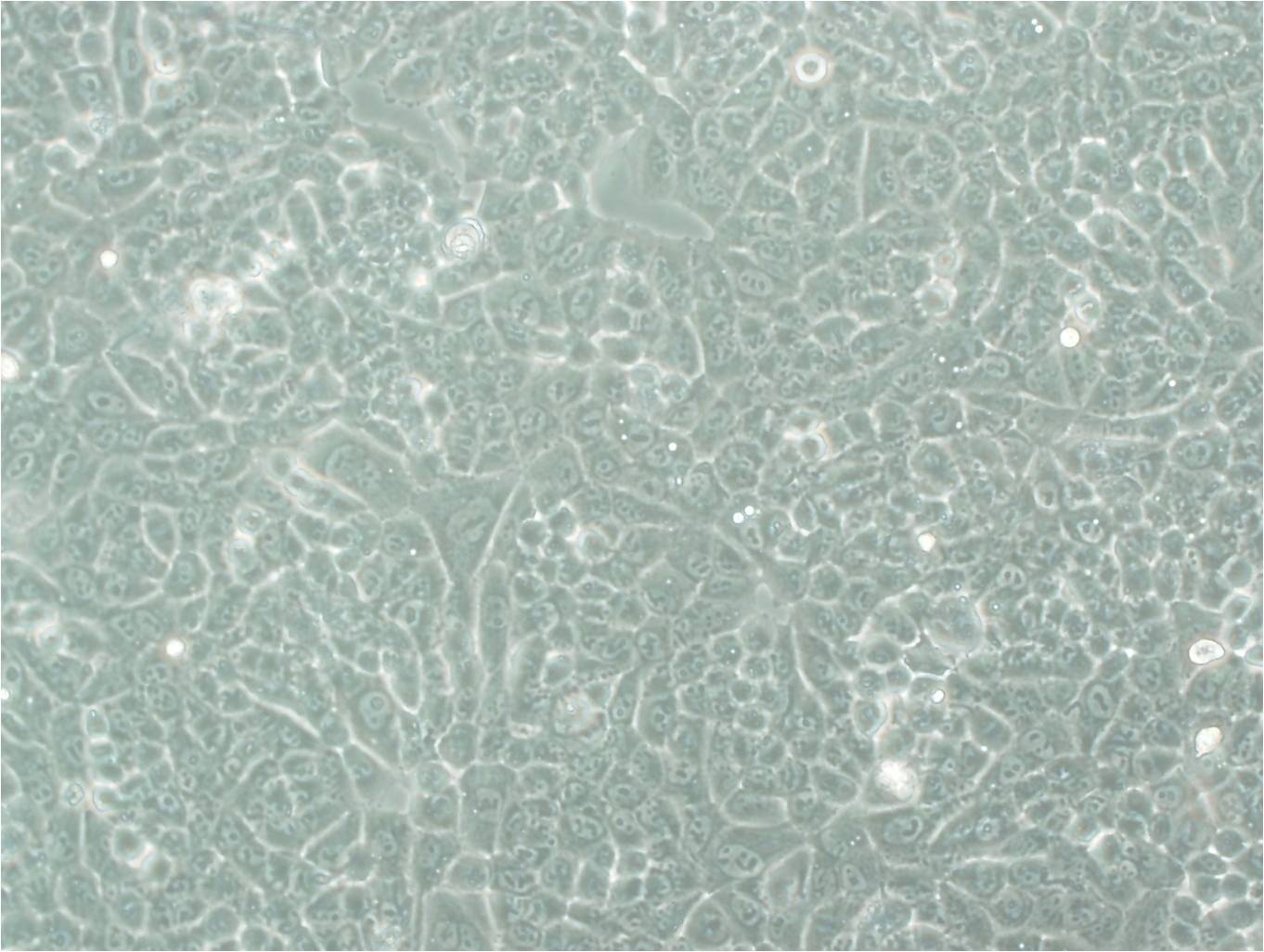 NCI-H441细胞：人肺腺癌细胞系
