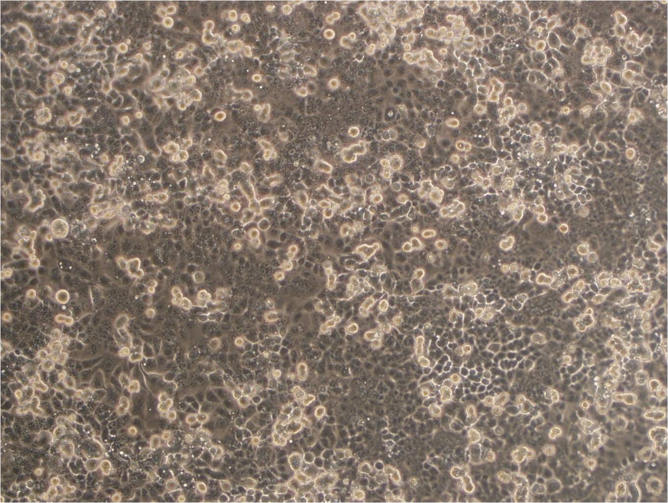 LLC-WRC 256 cell lineWalker氏癌肉瘤256瘤细胞系