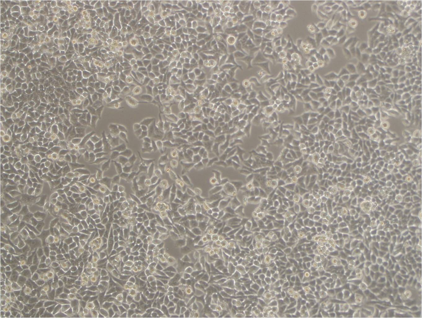NTERA-2 cell line人恶性多发性畸胎瘤细胞系