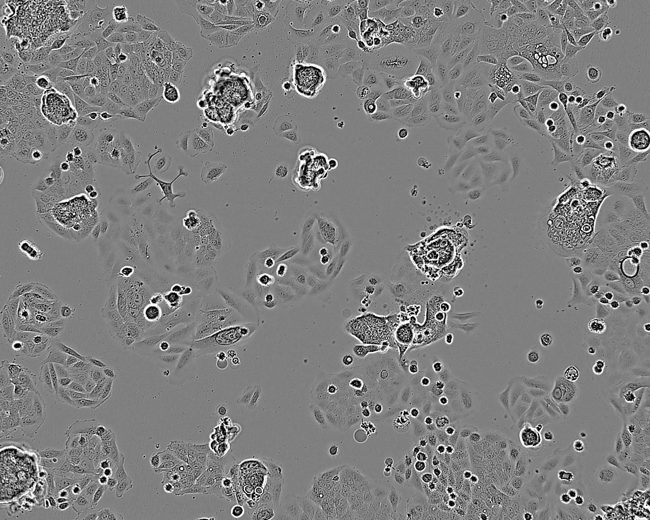 HK-2 [Human kidney]细胞：人肾小管上皮细胞系