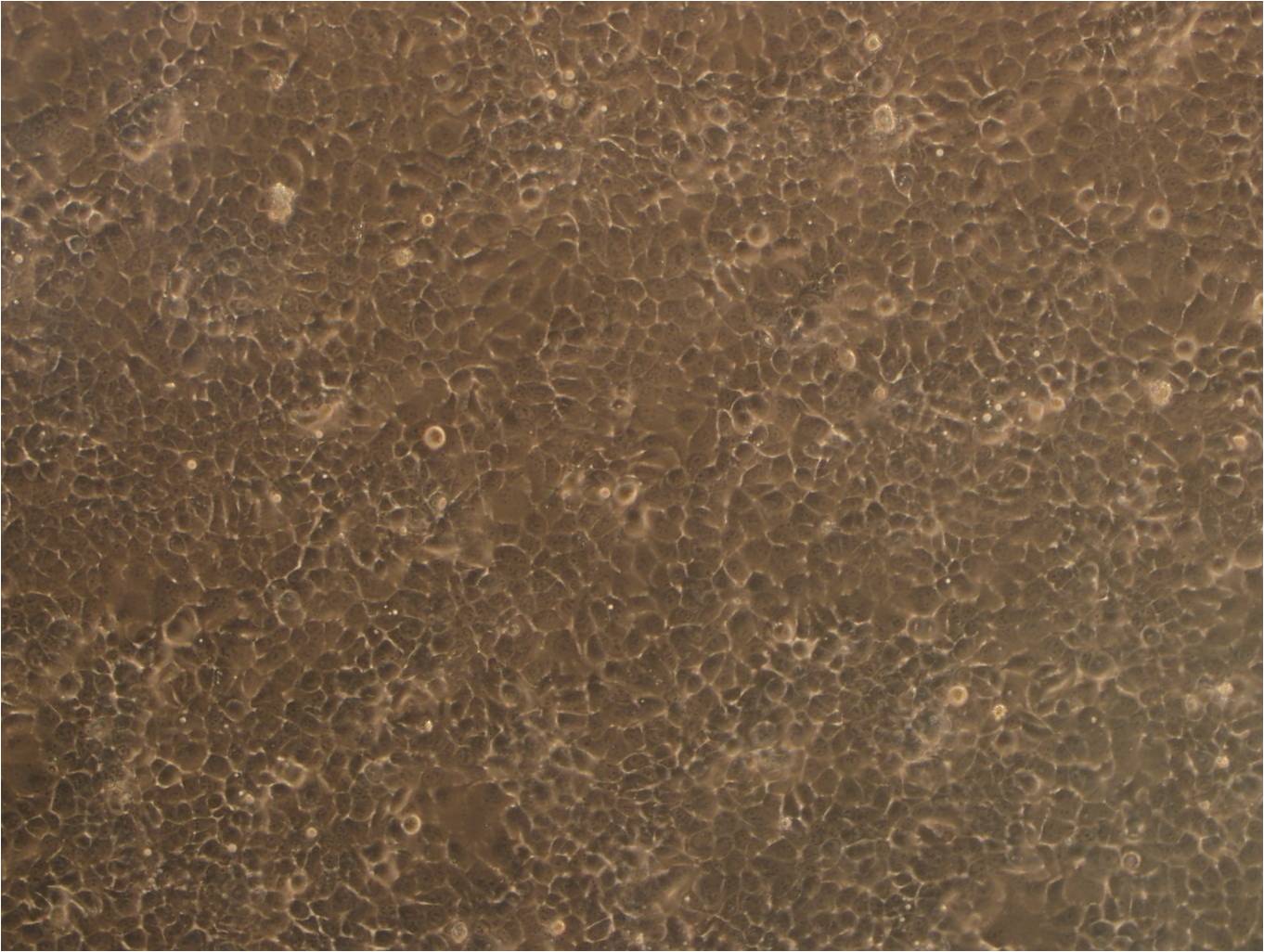 NCI-H1838细胞：人非小细胞肺癌细胞系