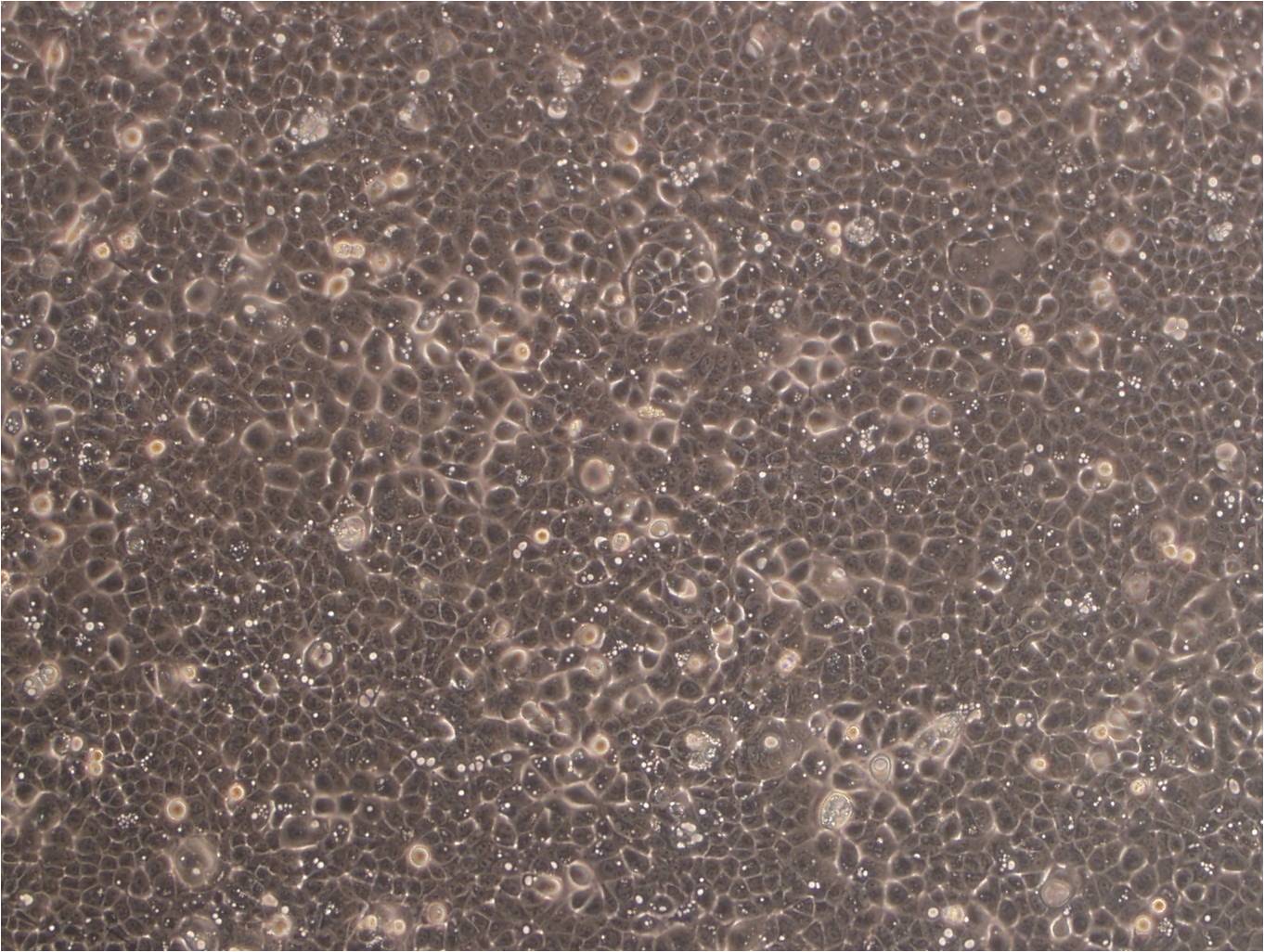 NCI-H2009细胞：人肺腺癌细胞系