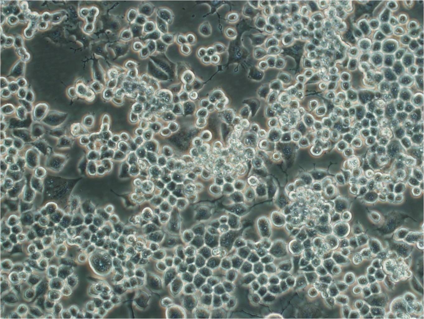 COLO 829细胞：人黑色素瘤细胞系