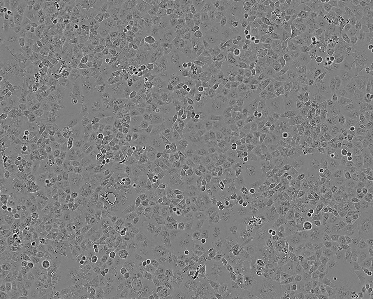 COLO 320DM细胞：人结直肠腺癌细胞系