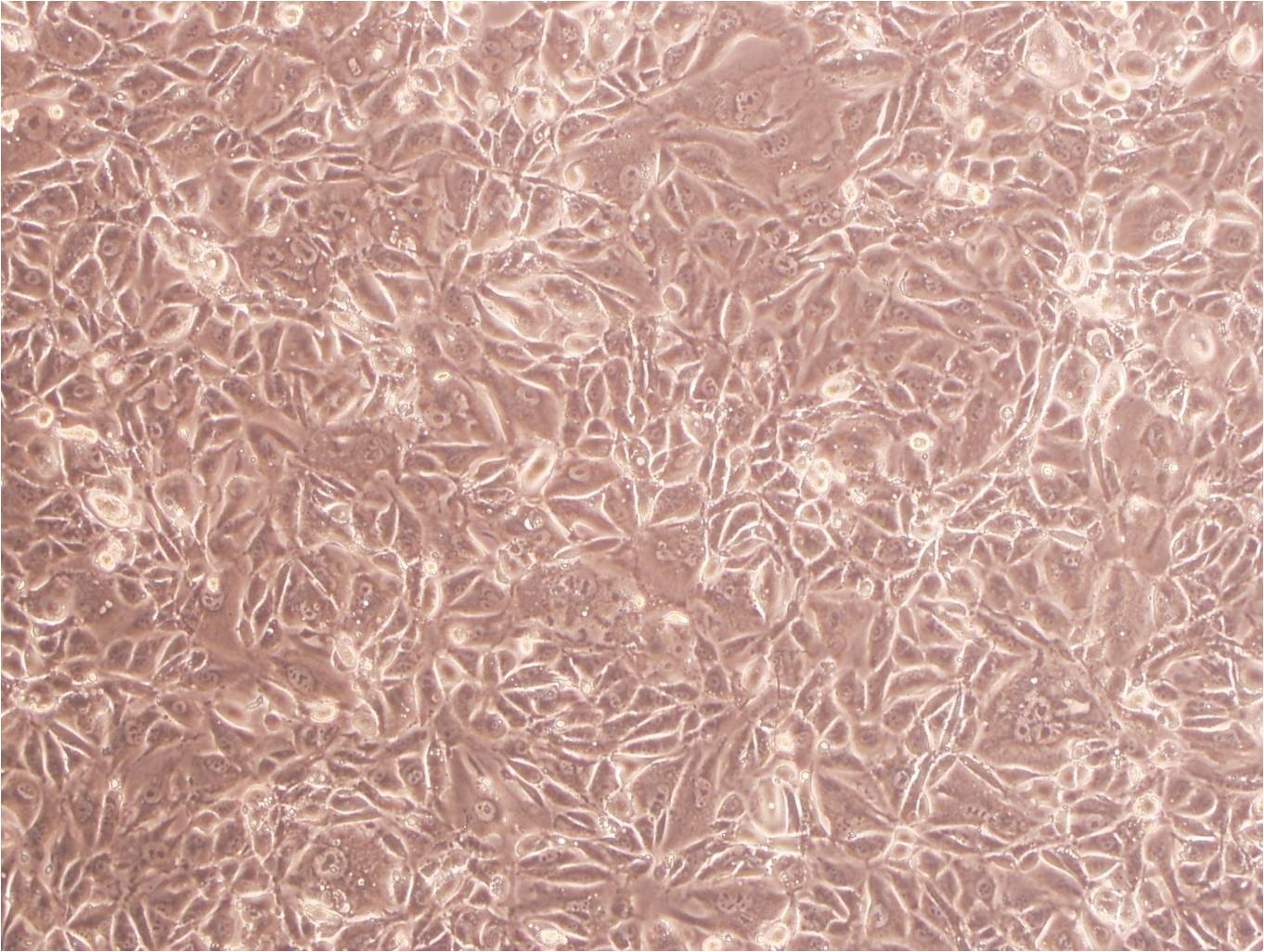 C8161 cell line人黑色素瘤细胞系