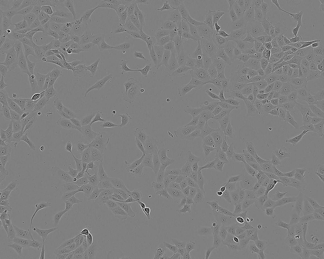 KYSE-450 Cells|人食管癌细胞系