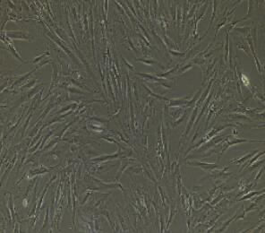 气管平滑肌细胞