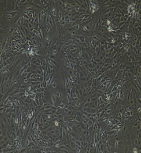 肾小管上皮细胞