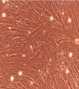 输尿管平滑肌细胞