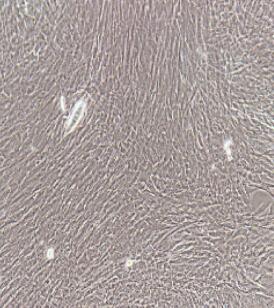 膀胱平滑肌细胞