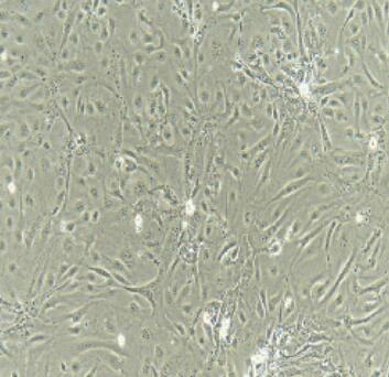 甲状腺上皮细胞