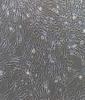 扁桃体动脉内皮细胞