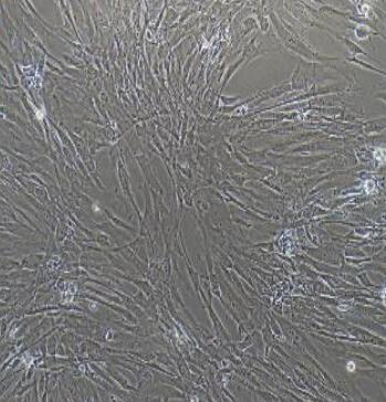 扁桃体动脉平滑肌细胞
