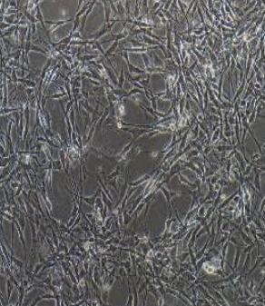 甲状腺微血管内皮细胞