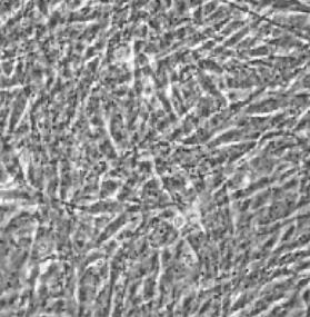 输卵管平滑肌细胞