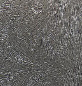 宫颈成纤维细胞